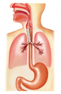 逆流性食道炎のイラスト